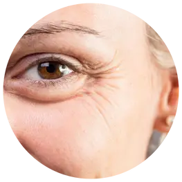 Botox Leesburg VA