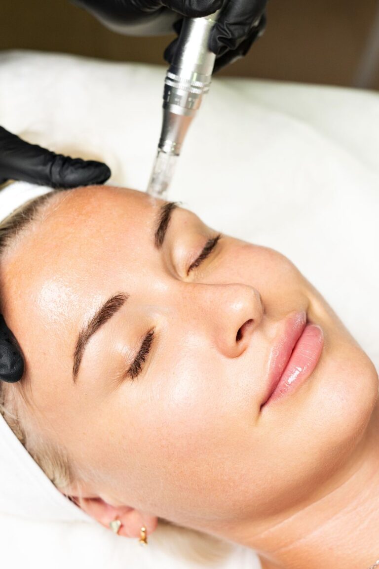 microneedling in leesburg va