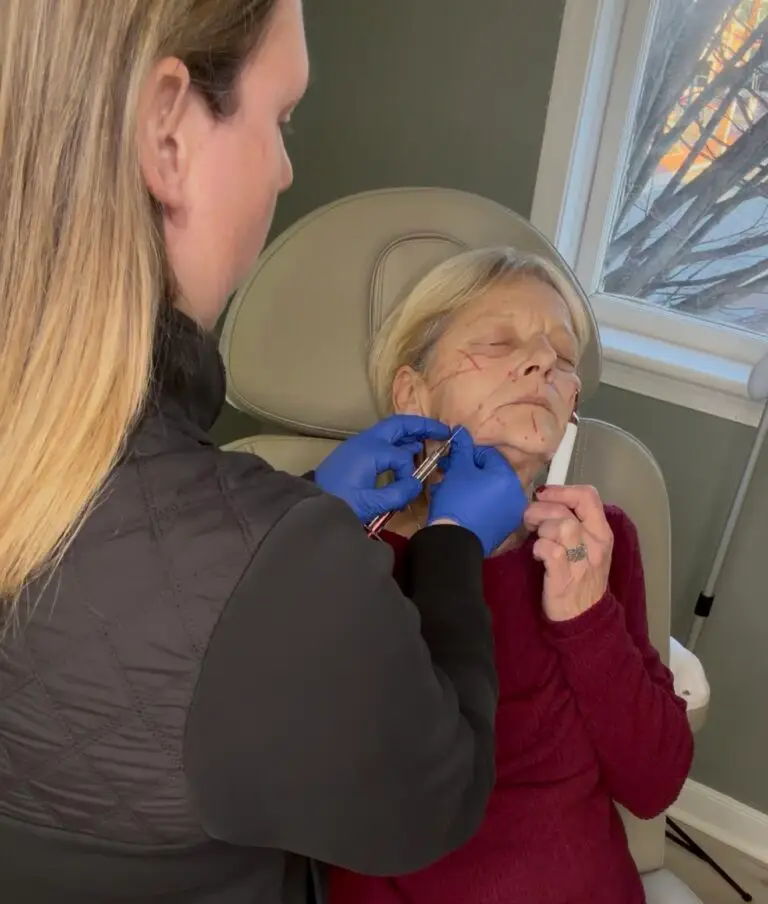 Facial balancing with dermal filler at Noeli Total Wellness in Leesburg, VA